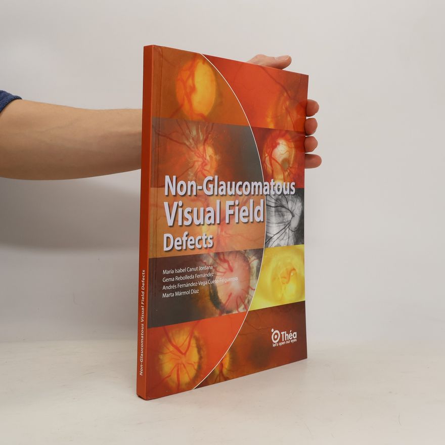 Autores varios Non-Glaucomatous Visual Field Defects