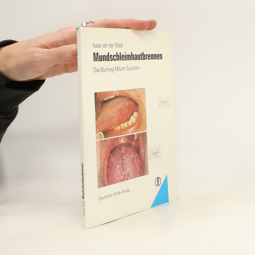 Isaäc van der Waal Mundschleimhautbrennen