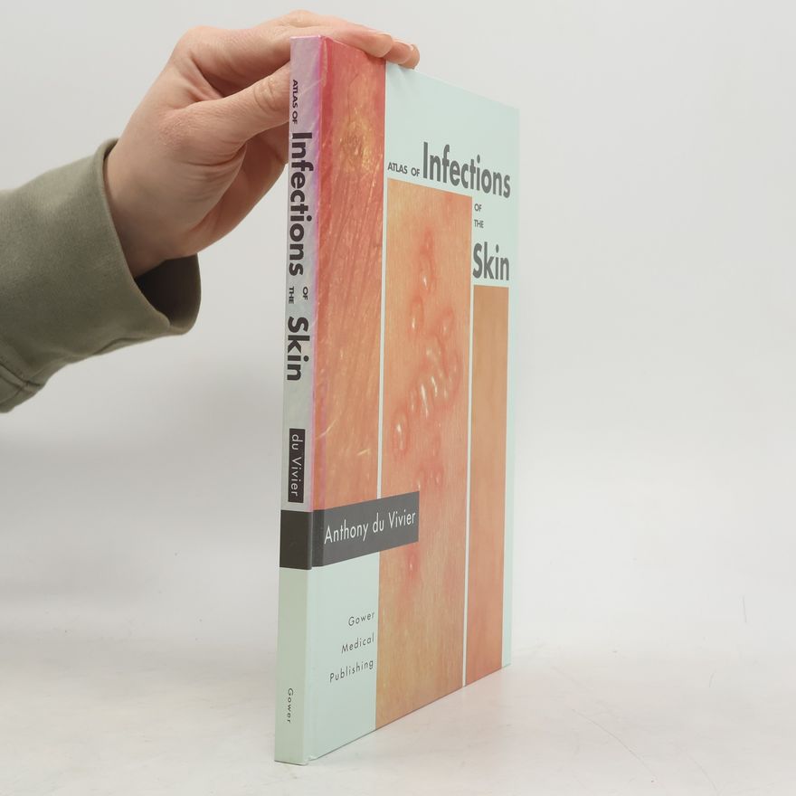 Anthony Du Vivier Atlas of Infections of the Skin