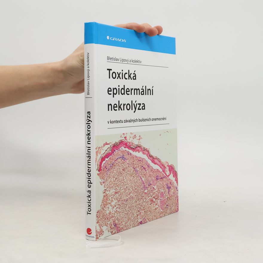 Břetislav Lipový Toxická epidermální nekrolýza v kontextu závažných bulózních onemocnění