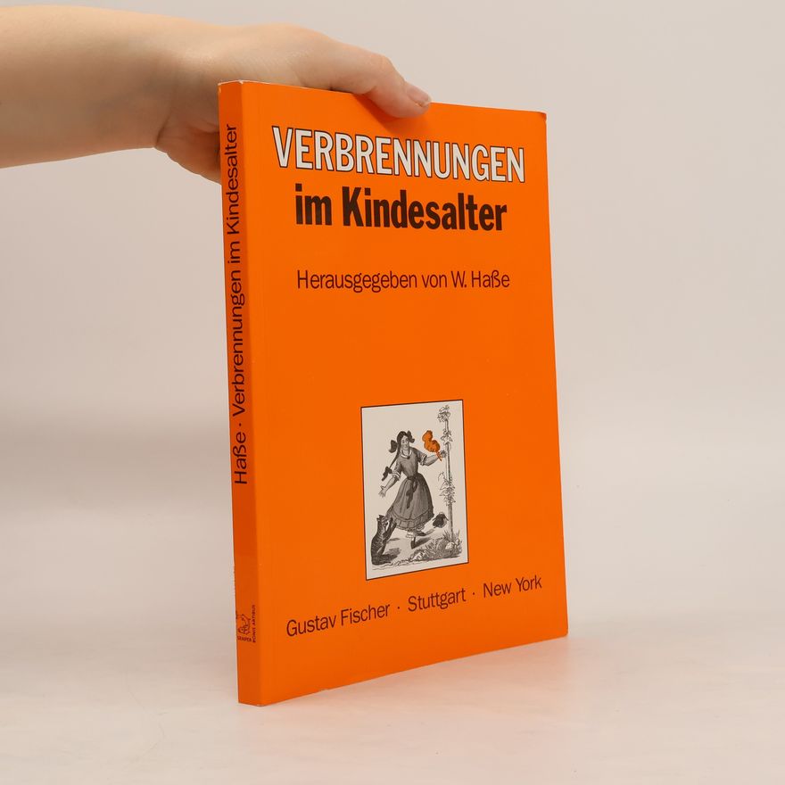Wolfgang Haße Verbrennungen im Kindesalter