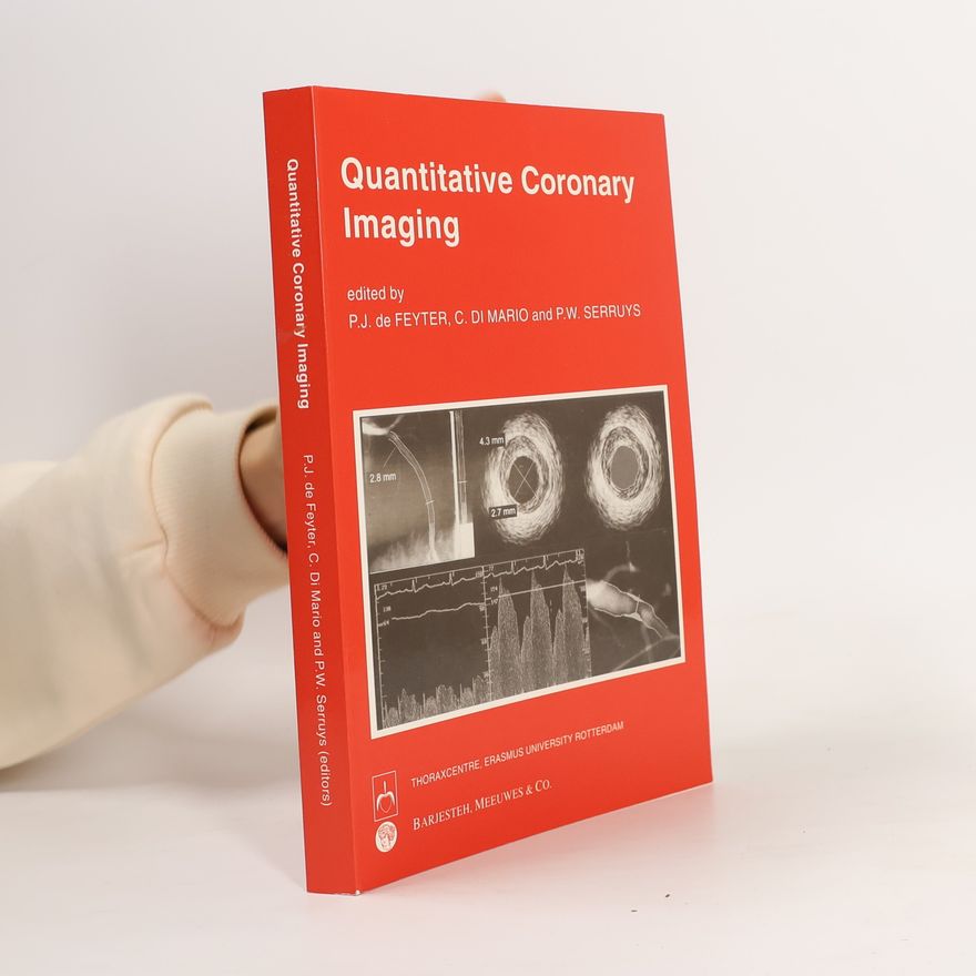 P.W. Serruys Quantitative Coronary Imaging
