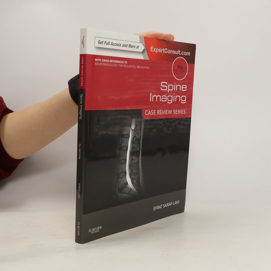 Efrat Saraf-Lavi MD Spine Imaging