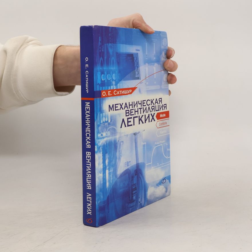 Олег Евгеньевич Сатишур Механическая вентиляция легких