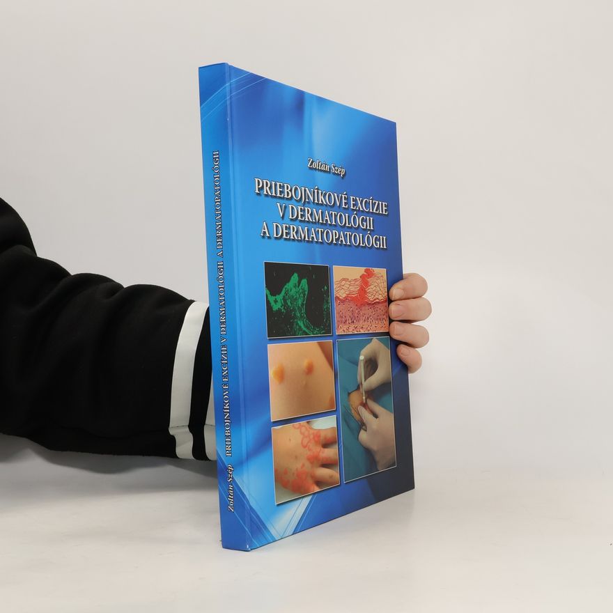 Zoltán Szép Priebojníkové excízie v dermatológii a dermatopatológii
