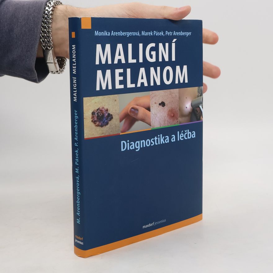 Marek Pásek Maligní melanom: diagnostika a léčba na základě aktuálního doporučeného postupu