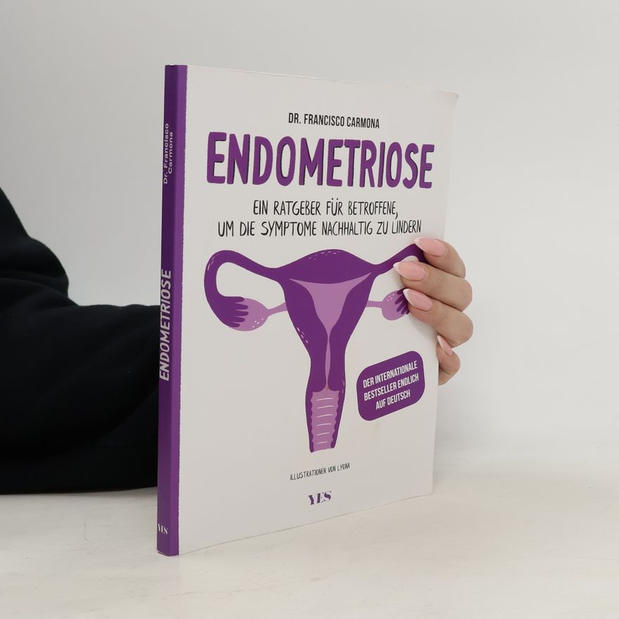 Francisco Carmona Endometriose