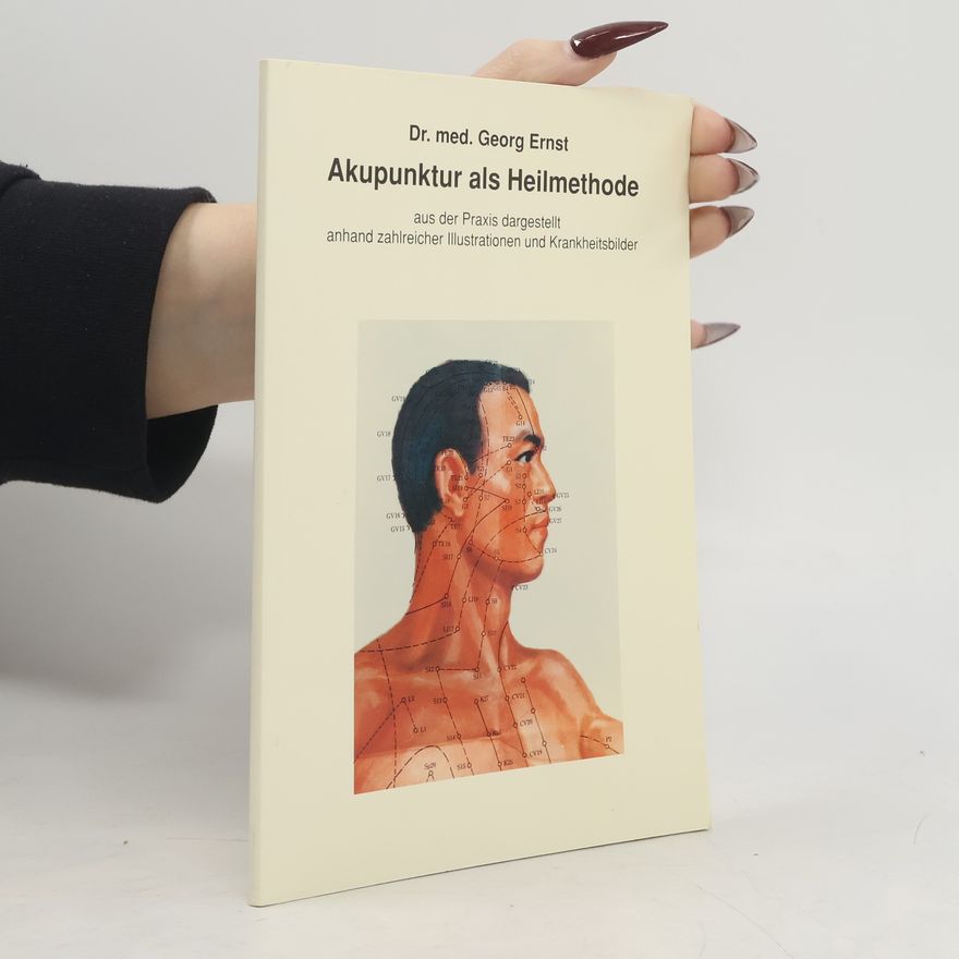 Dr. med. Georg Ernst Akupunktur als Heilmethode aus der Praxis dargestellt anhand zahlreicher Illustrationen und Krankheitsbilder