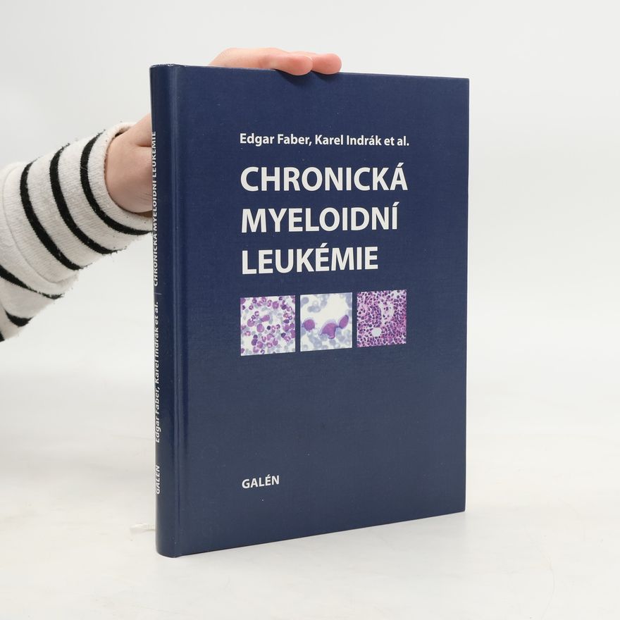 Karel Indrák Chronická myeloidní leukémie