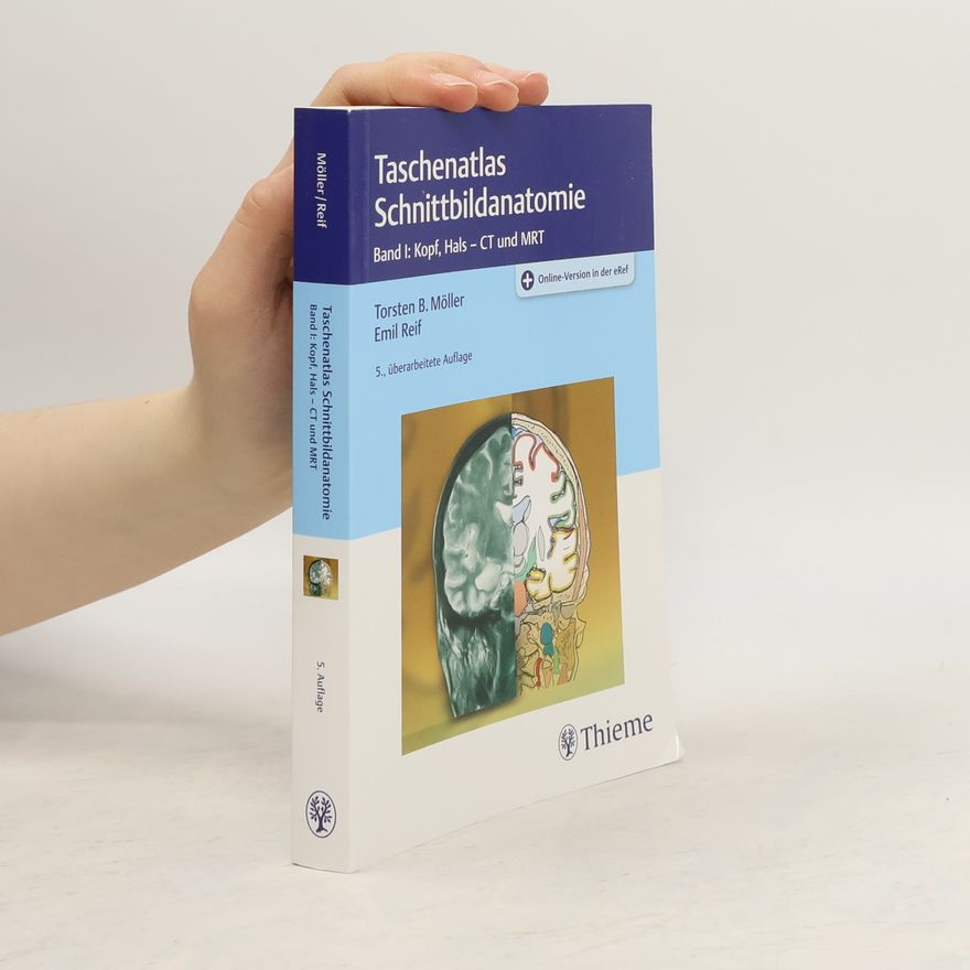 Torsten B. Möller Taschenatlas Schnittbildanatomie