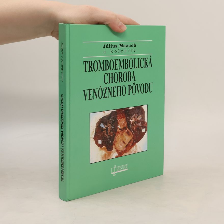Július Mazuch Tromboembolická choroba venózneho pôvodu