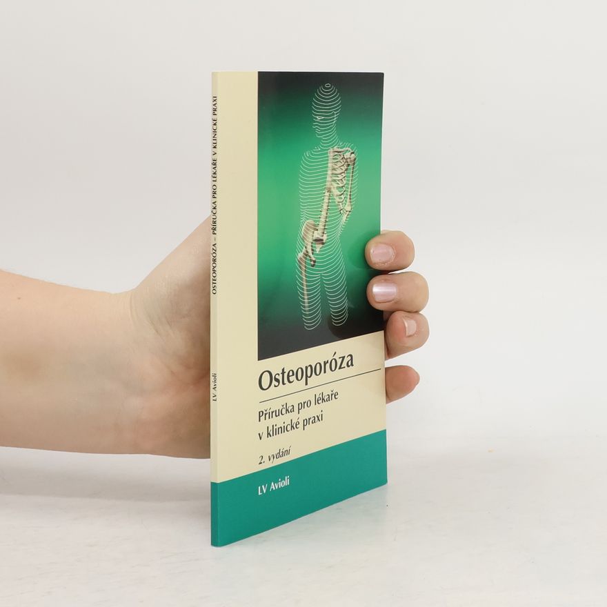 Autores varios Osteoporóza. Příručka pro lékaře v klinické praxi