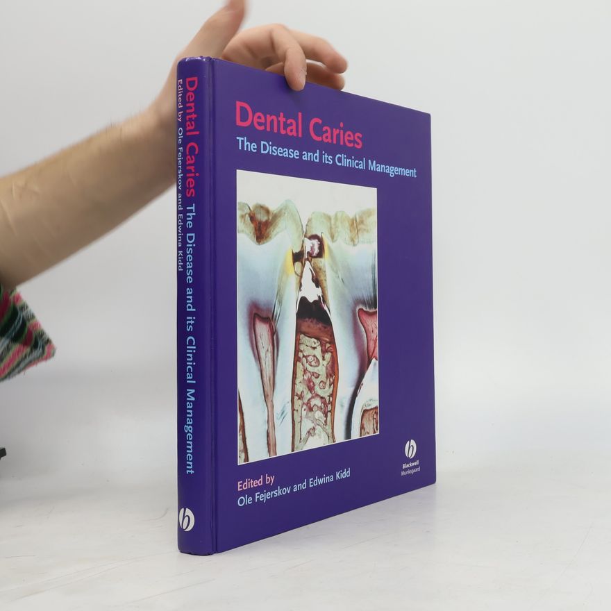 Edwina A. M. Kidd Dental Caries