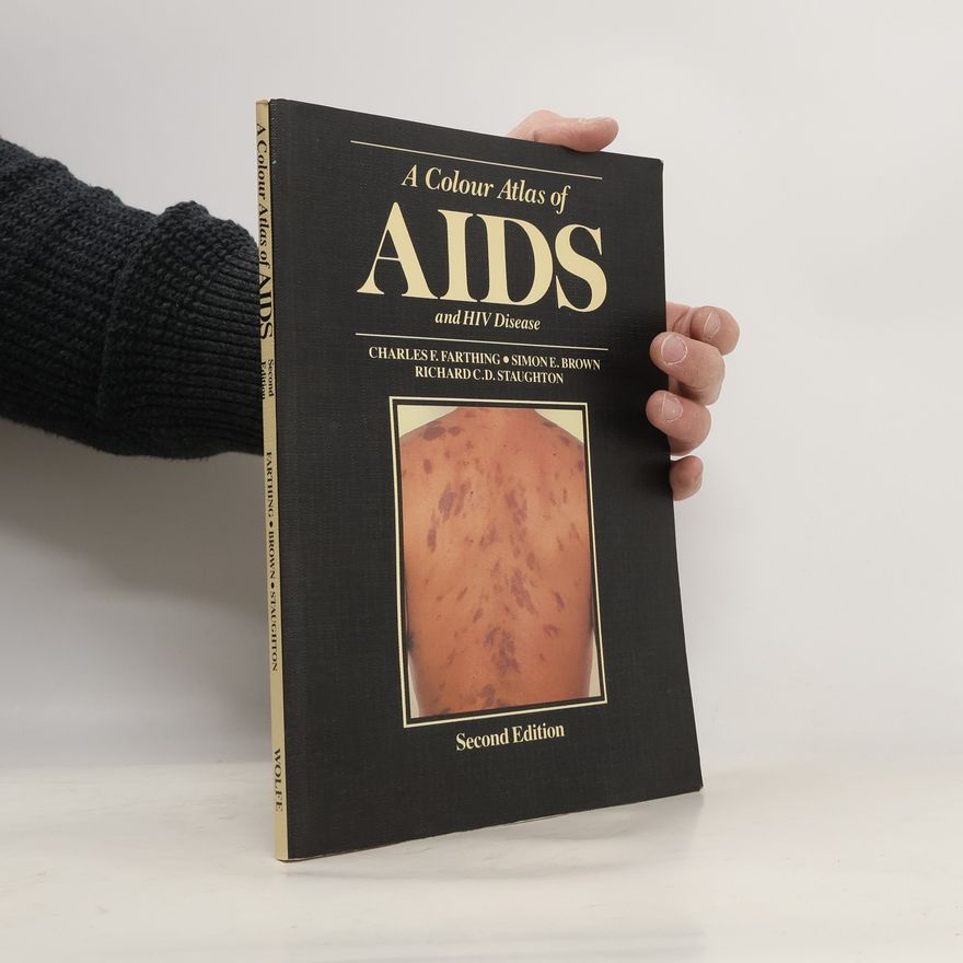 Richard C.D. Staughton A Colour Atlas of AIDS