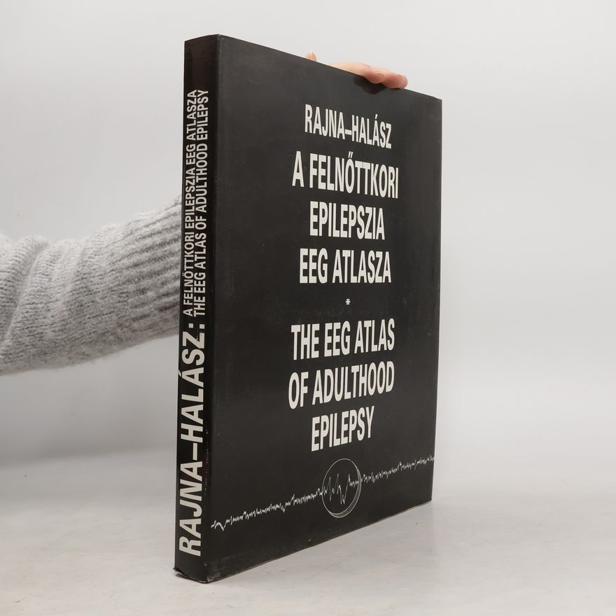 Péter Rajna EEG Atlas of Adulthood Epilepsy