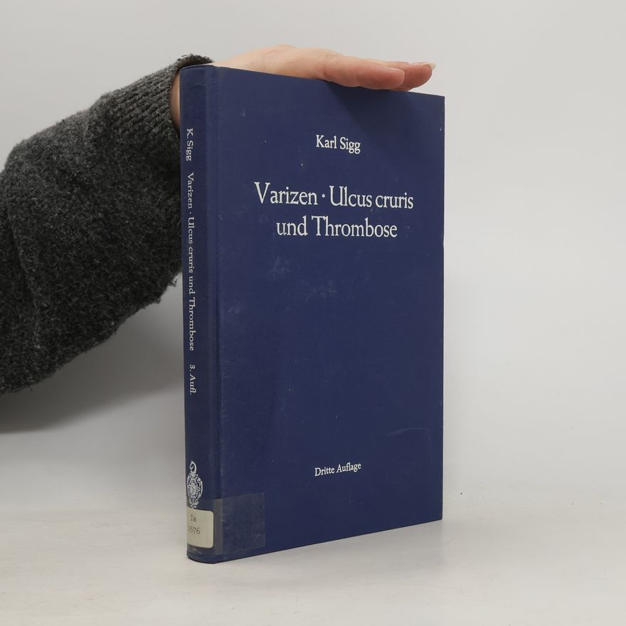 Karl Sigg Varizen. Ulcus cruris und Thrombose