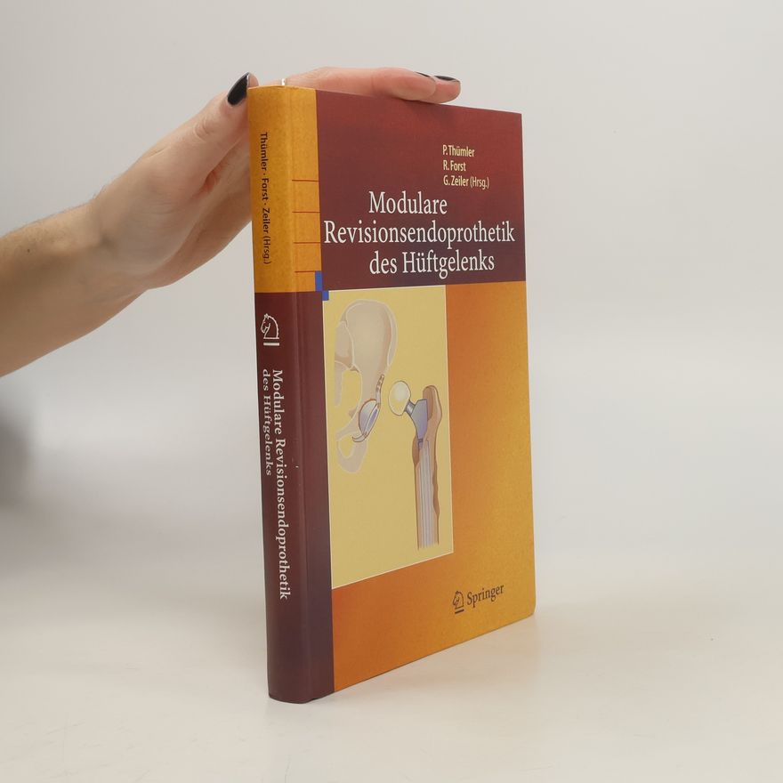 Günther Zeiler Modulare Revisionsendoprothetik des Hüftgelenks