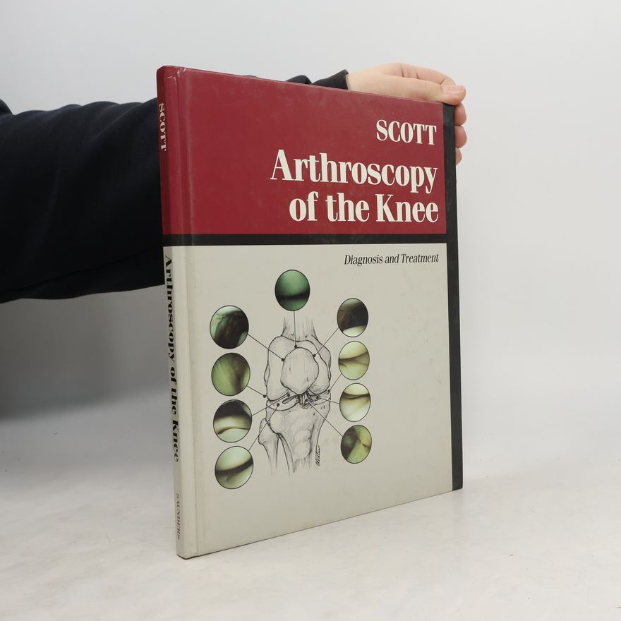 W. Norman Scott Arthroscopy of the Knee