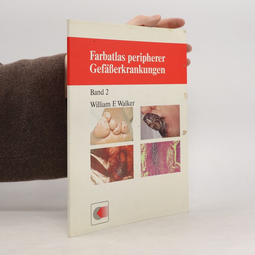 William F. Walker Farbatlas peripherer Gefässerkrankungen. Band 2.