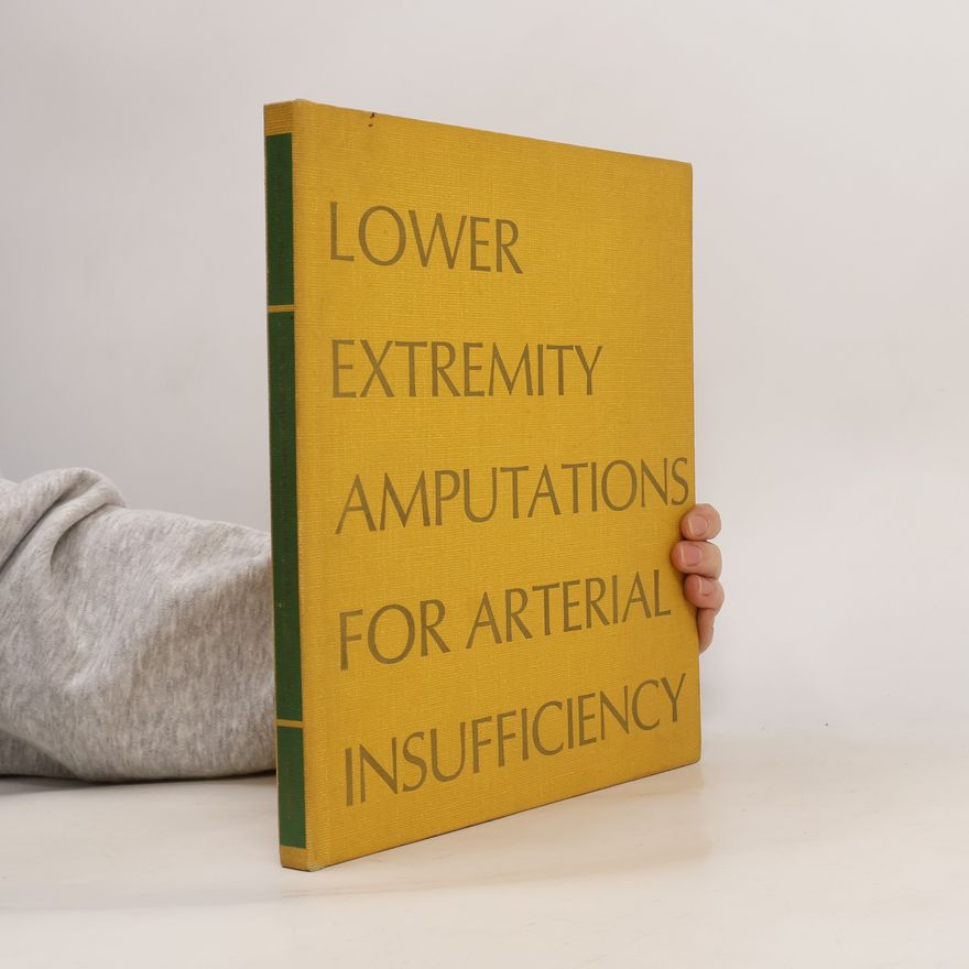 Kolektiv autorů Lower Extremity Amputations for Arterial Insufficiency