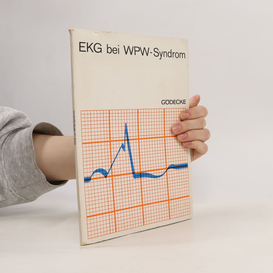 Kolektiv autorů EKG bei WPW-Syndrom