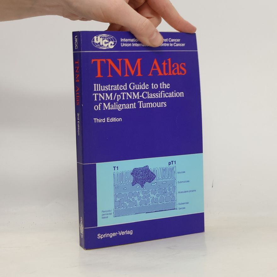 Bernd Spiessl UICC: TNM Atlas