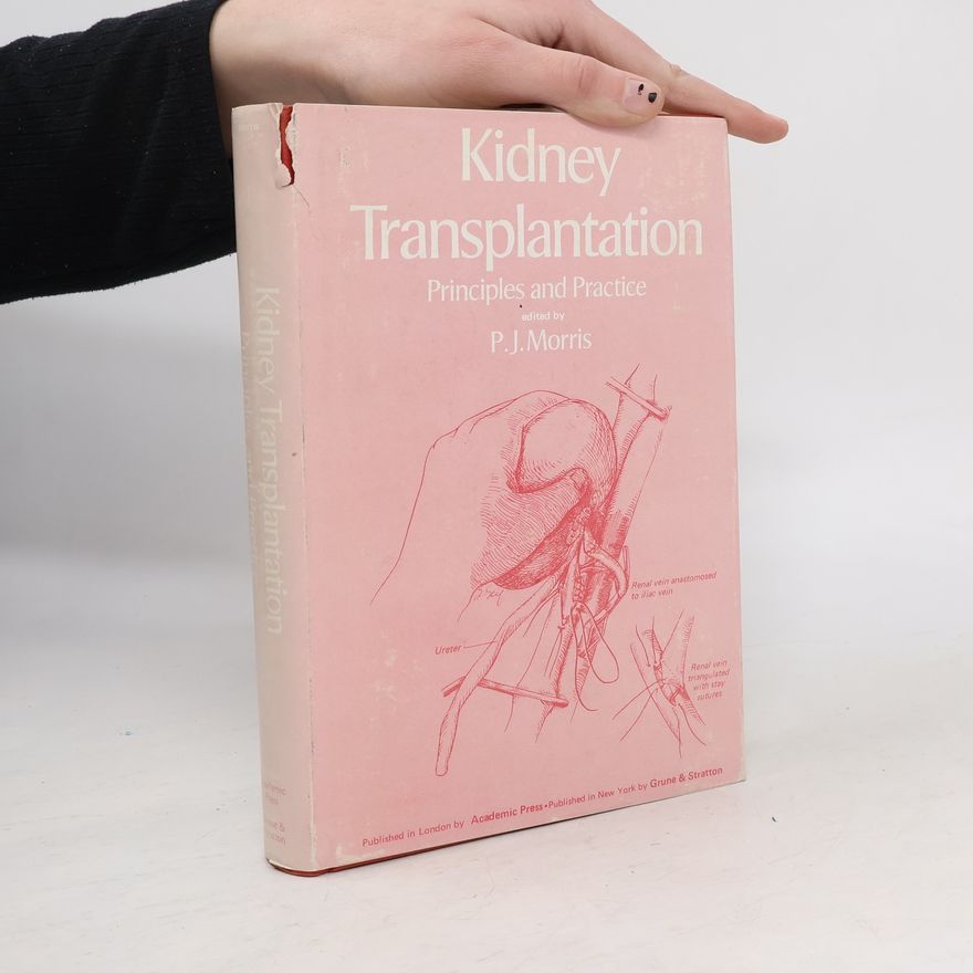AA.VV. Kidney Transplantation. Principles and Practice