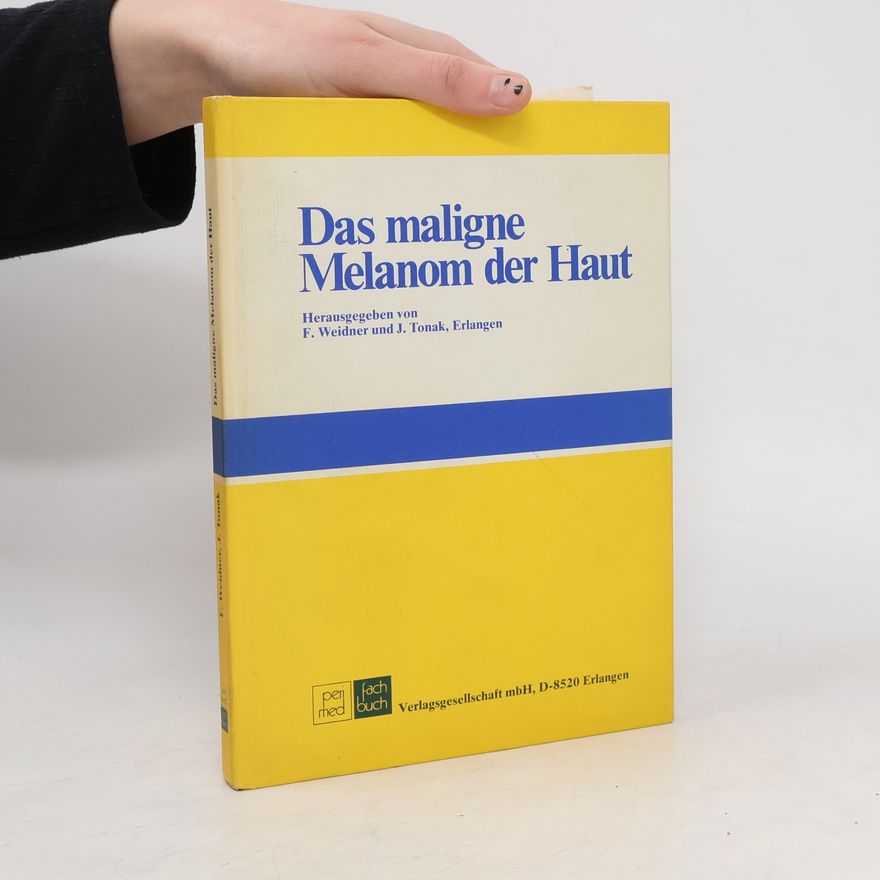 Jürgen Tonak Das maligne Melanom der Haut