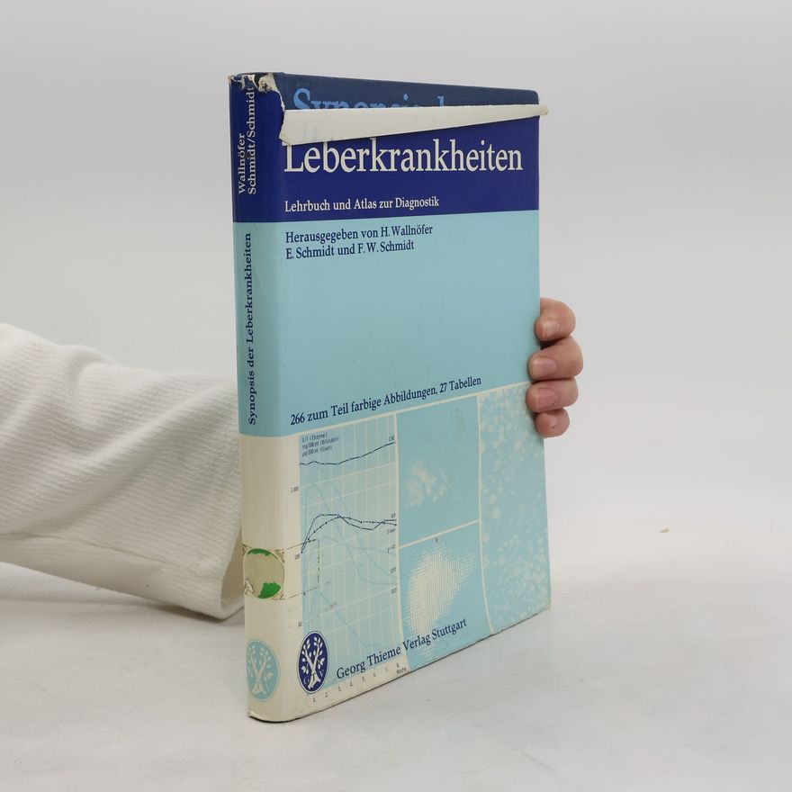 F. W. Schmidt Synopsis der Leberkrankheiten