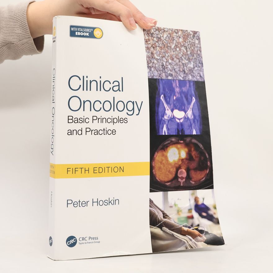 Peter Hoskin, M.D. Clinical Oncology