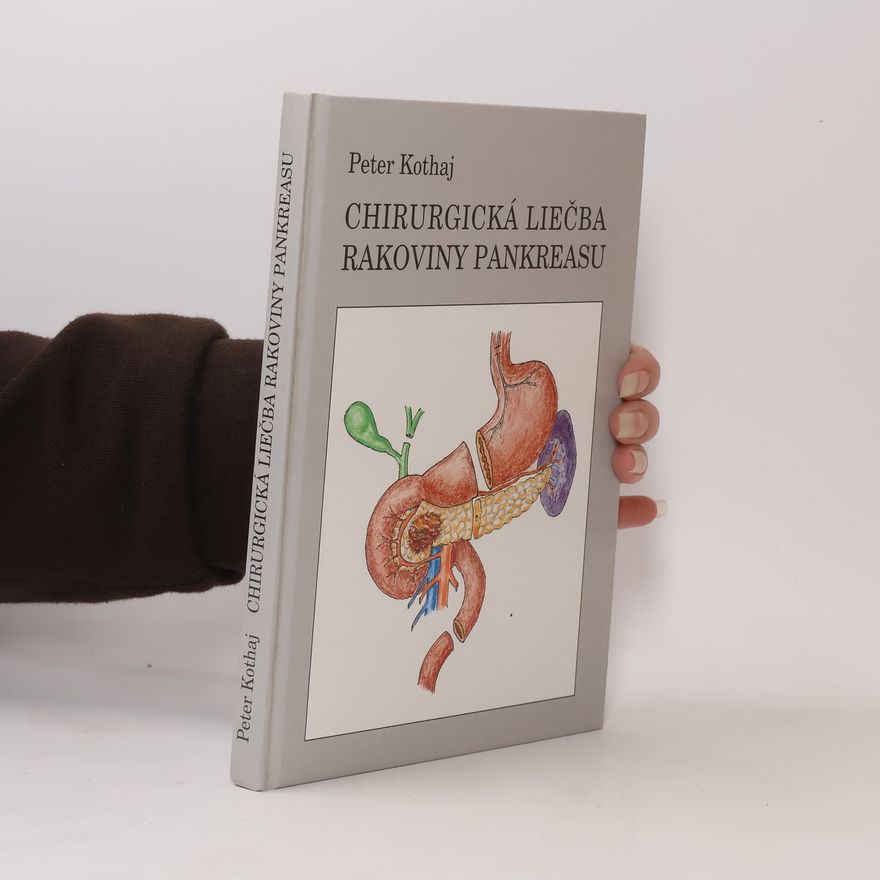 Peter Kothaj Chirurgická liečba rakoviny pankreasu