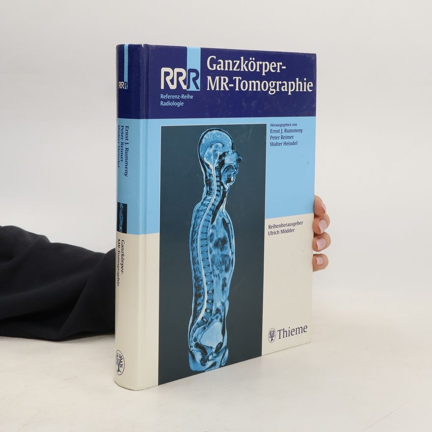 A. Beer Ganzkörper-MRT