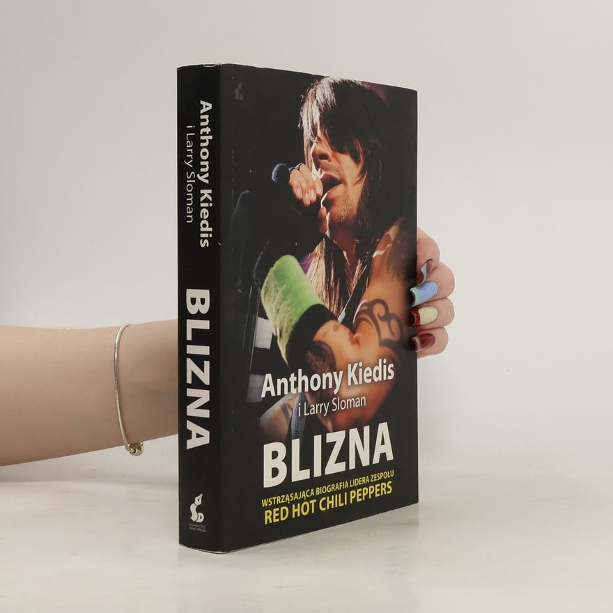 Anthony Kiedis Blizna