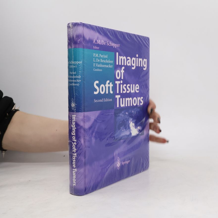 L. De Beuckeleer Imaging of Soft Tissue Tumors