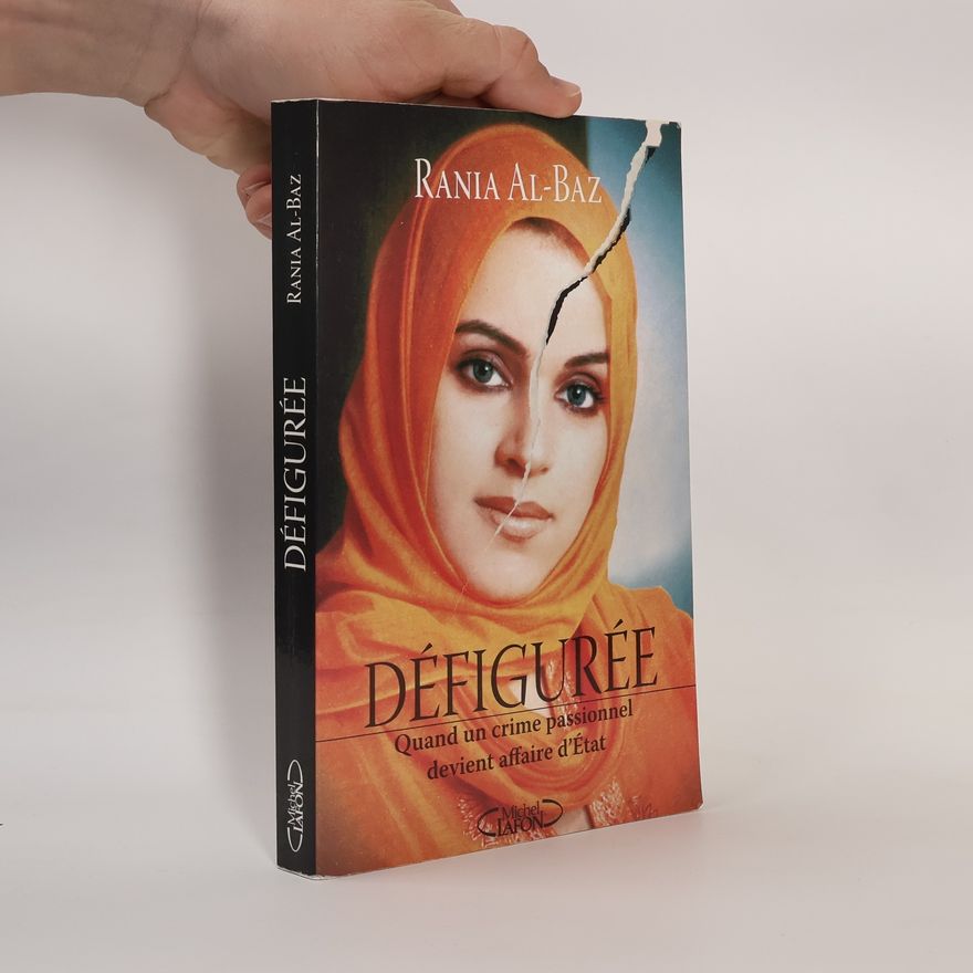 Rania Al-Baz Défigurée