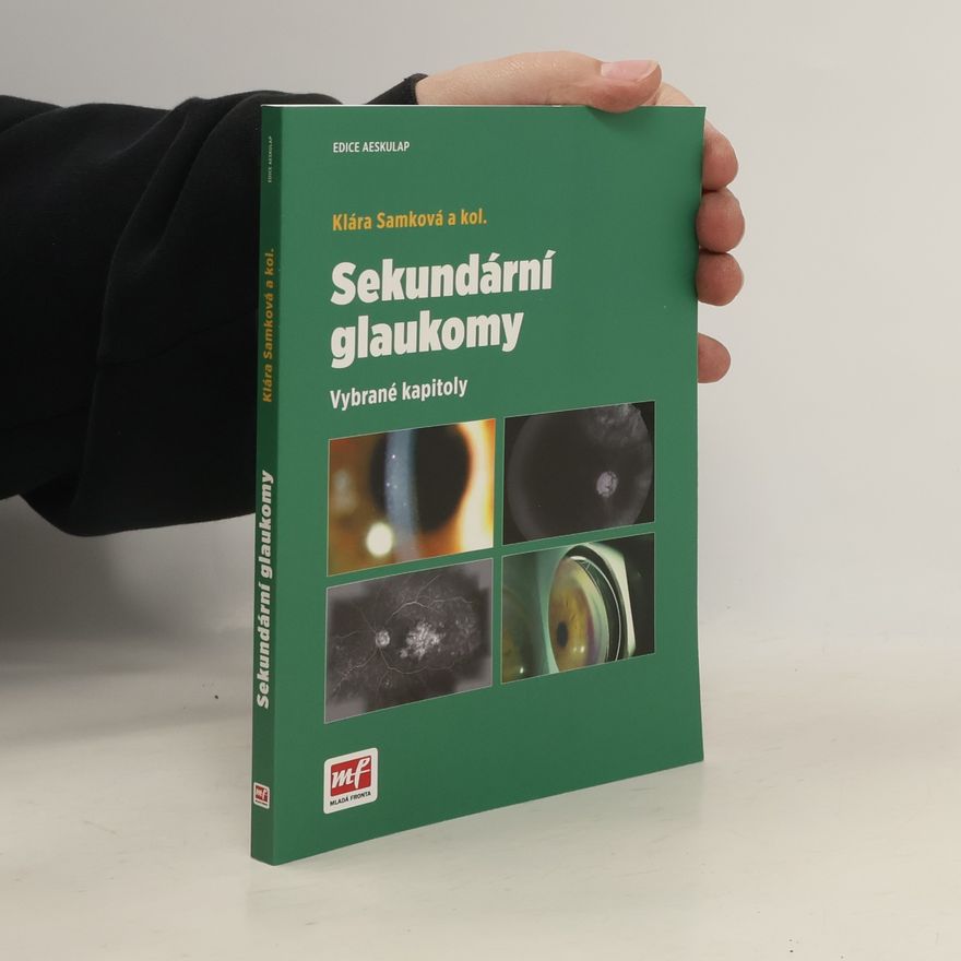 Klára A. Samková Sekundární glaukomy