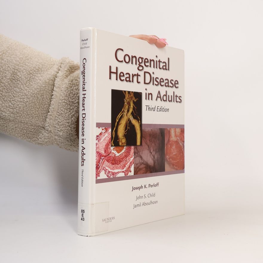 John S. Child Congenital Heart Disease in Adults - Third Edition
