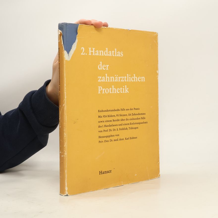 Collectif d'auteurs 2. Handatlas der zahnärztlichen Prothetik