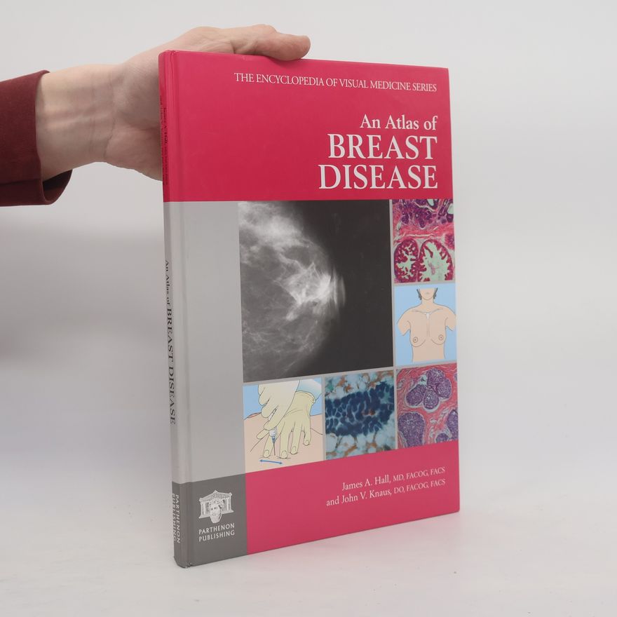 John V. Knaus The Encyclopedia of Visual Medicine Series - 63: An Atlas of Breast Disease