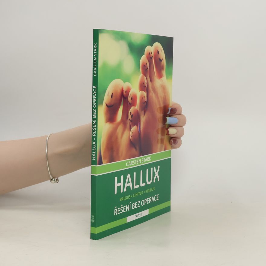 Carsten Stark Hallux – řešení bez operace