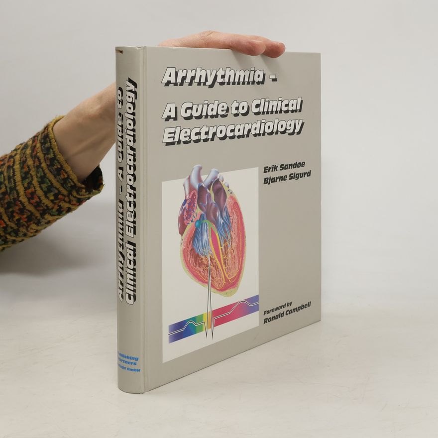 Erik Sandøe Arrhythmia