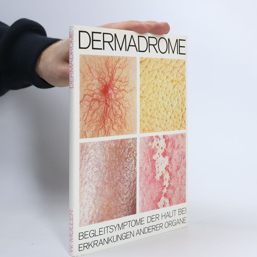 W. Müller Dermadrome