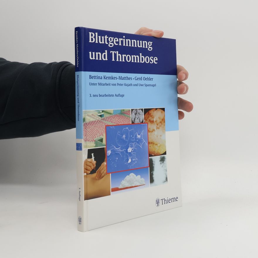 Bettina Kemkes Matthes Blutgerinnung und Thrombose