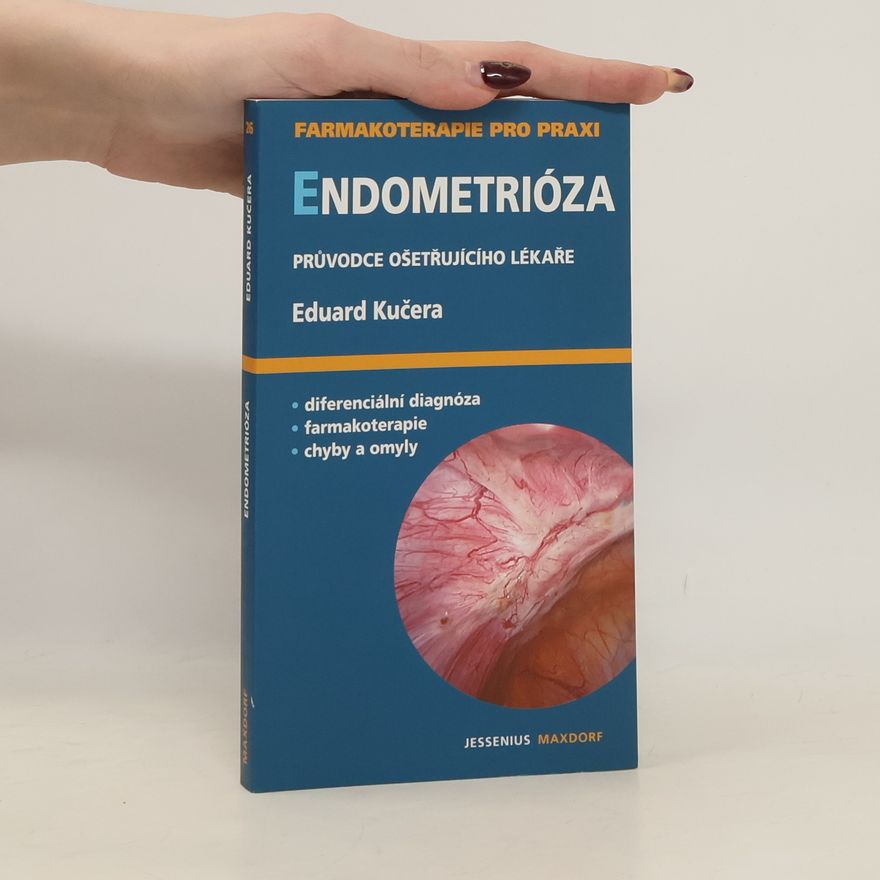 Eduard Kučera Endometrióza: průvodce ošetřujícího lékaře