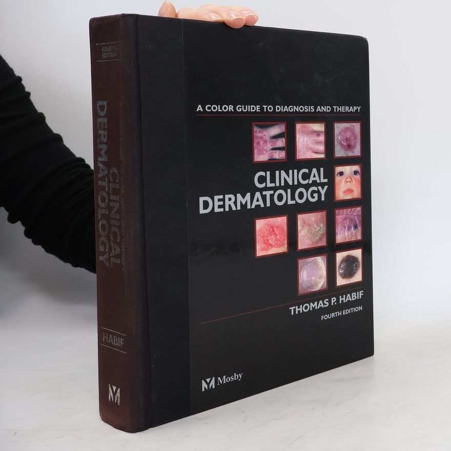 Thomas P. Habif MD Clinical Dermatology