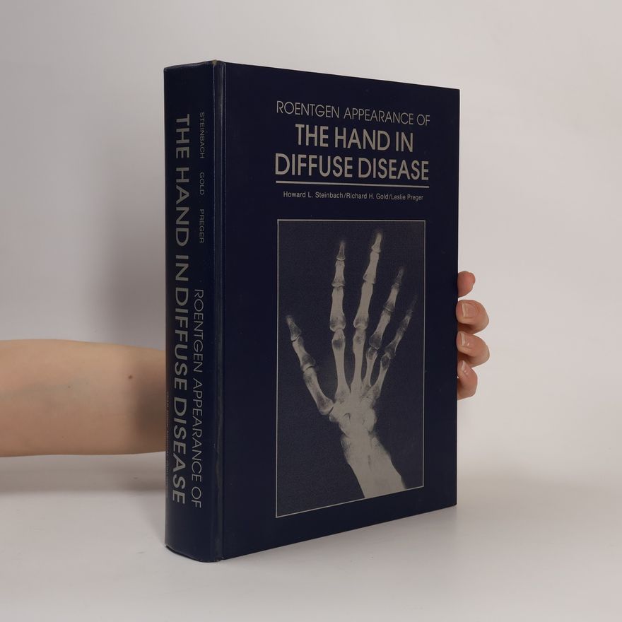 Howard L. Steinbach Roentgen Appearance of the Hand in Diffuse Disease