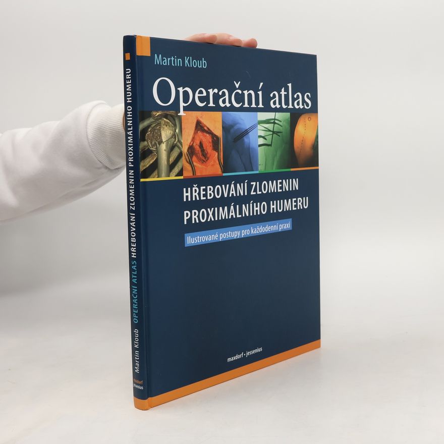 Martin Kloub Operační atlas hřebování zlomenin proximálního humeru