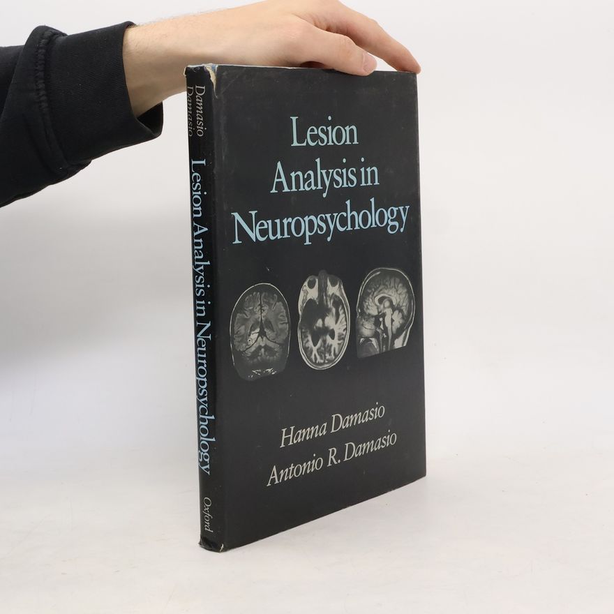 Hanna Damasio Lesion Analysis in Neuropsychology
