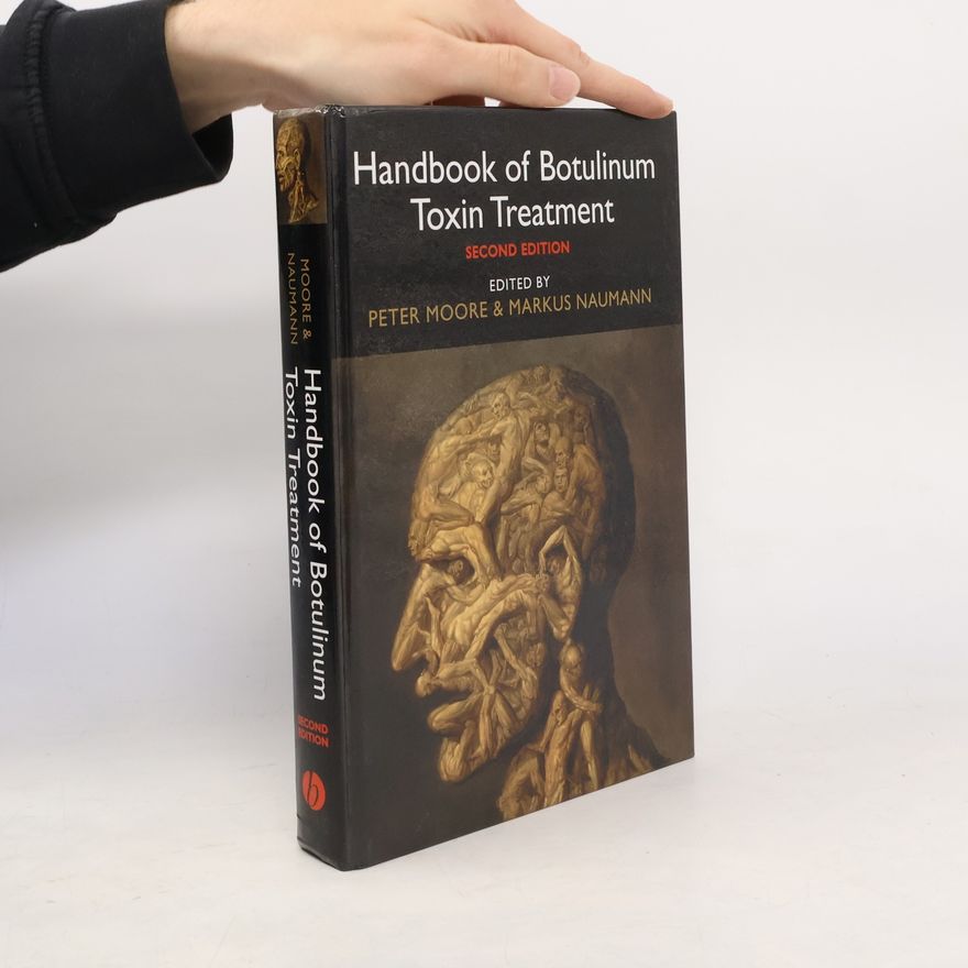 Markus Naumann Handbook of Botulinum Toxin Treatment