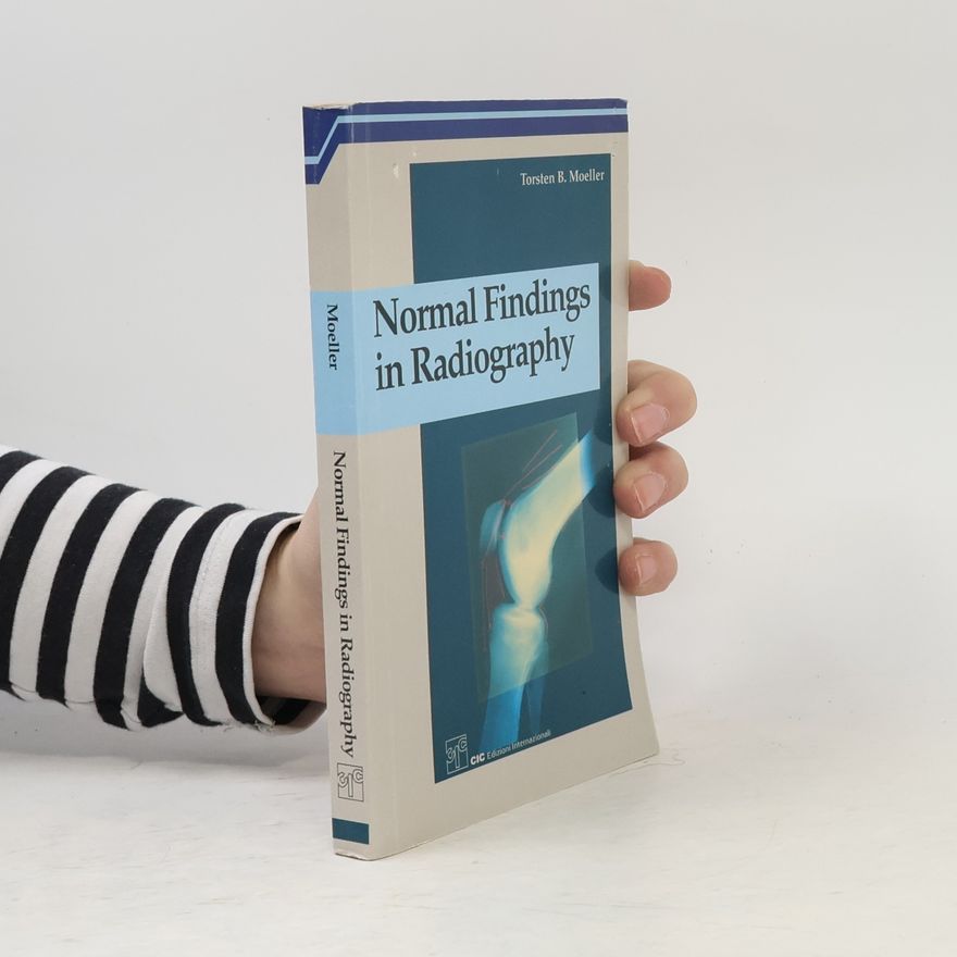 Torsten B. Moeller Normal Findings in Radiography